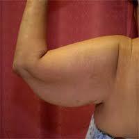 Dem+triceps+_62cd7129618c2eeb8a9a8f7dd58