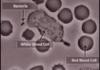 A white blood cell chasing bacteria.