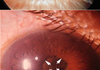 Awesome looking eye mutations